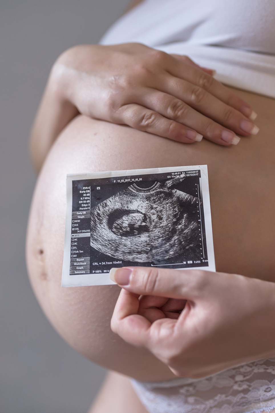 Close-up of belly of young pregnant model showing ultrasonic image of her baby. Future mom on her second trimester holding ultrasound scan of her child. Maternity concept